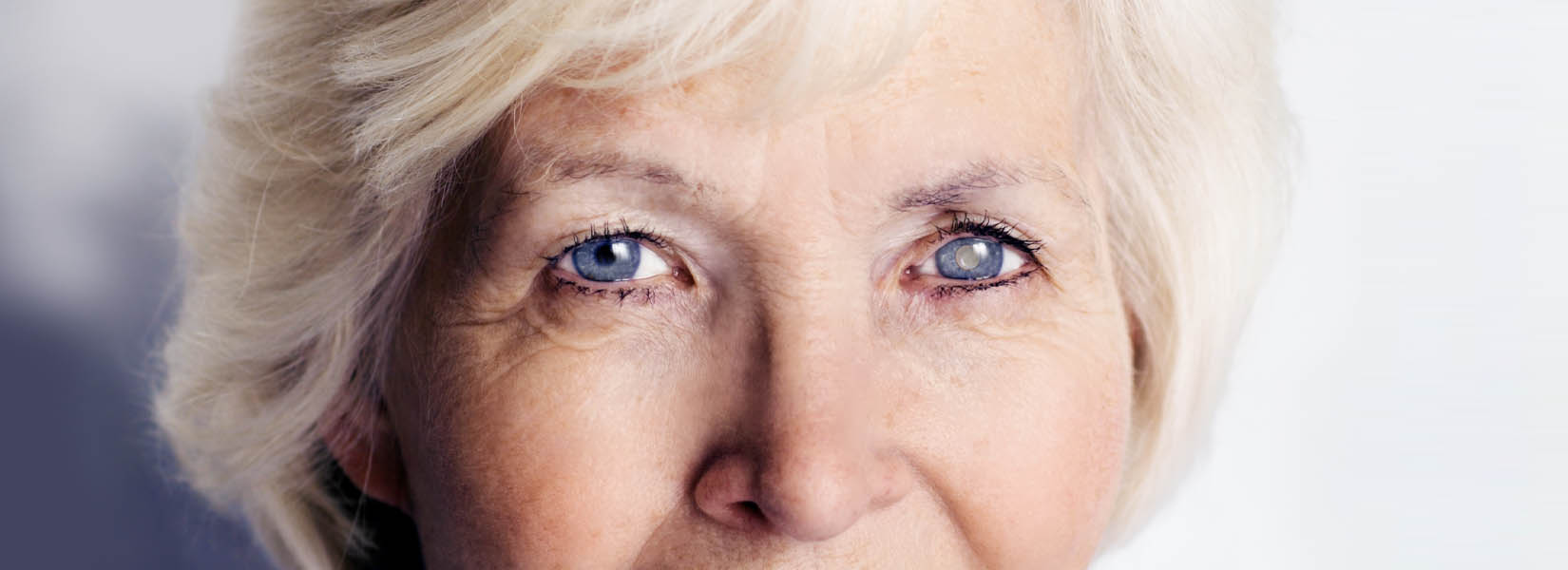 Cataract Surgery in Zillah